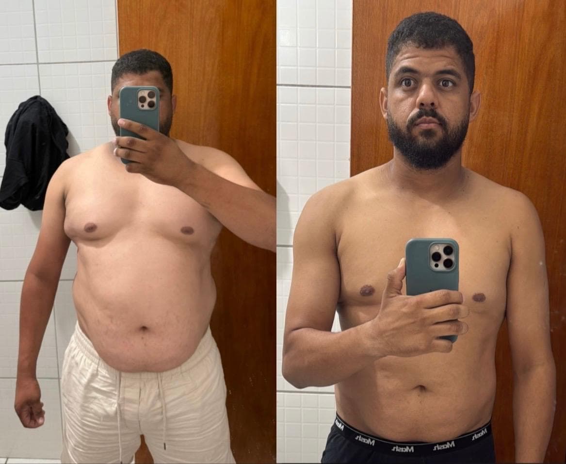 Foto de antes e depois de Robson