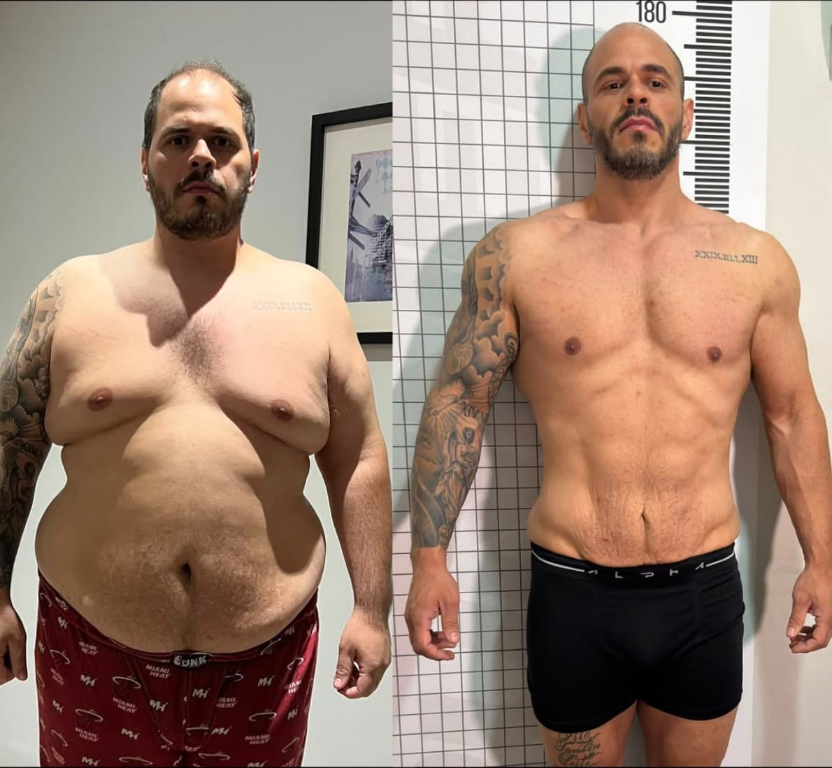 Foto de antes e depois de Rômulo